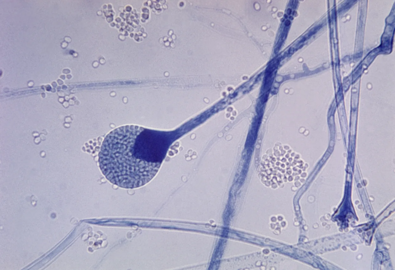 Absidia pernambucoensis (Absidia pernambucoensis) — photo mycologique