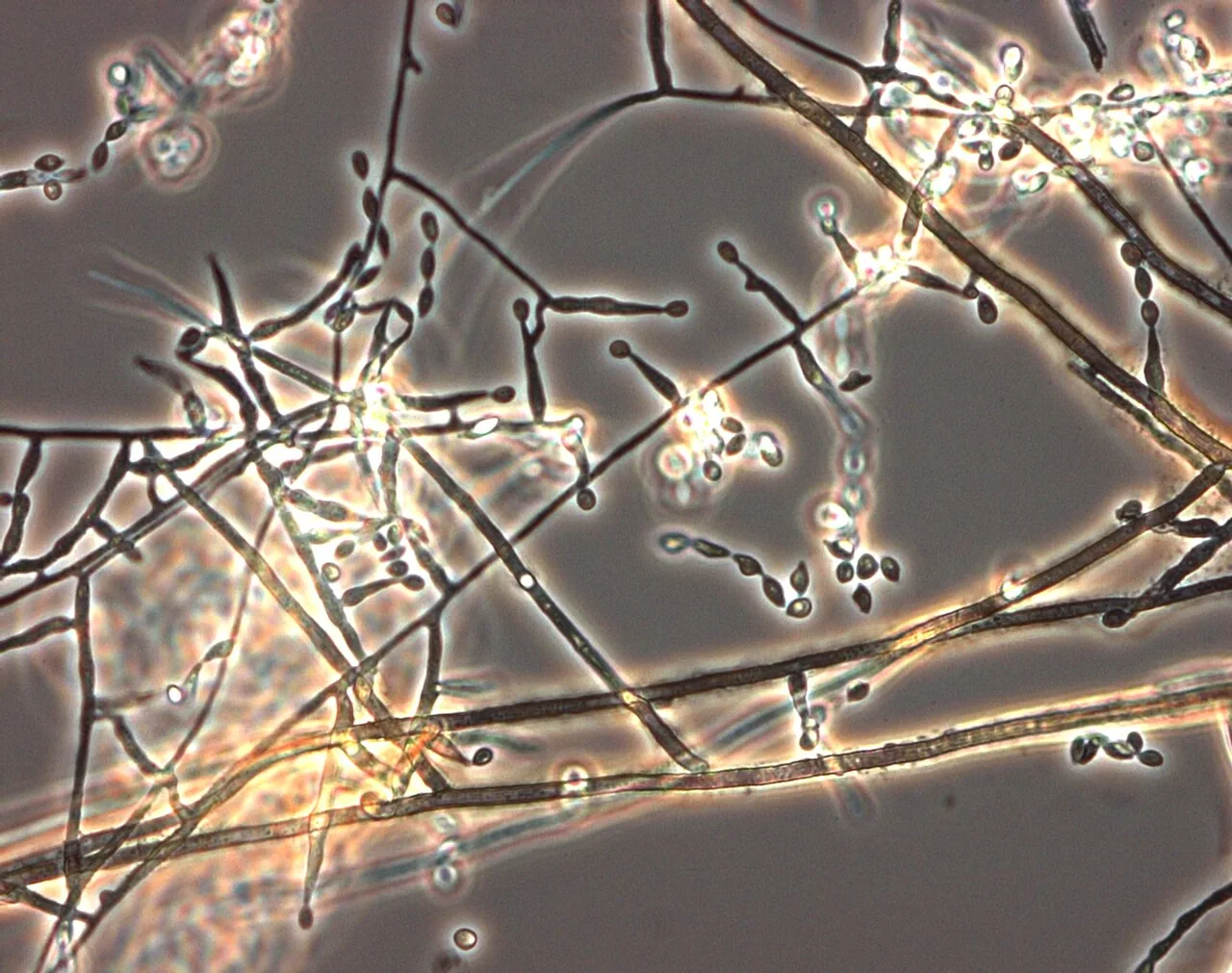 Acrophialophora fusispora (Acrophialophora fusispora) — photo mycologique