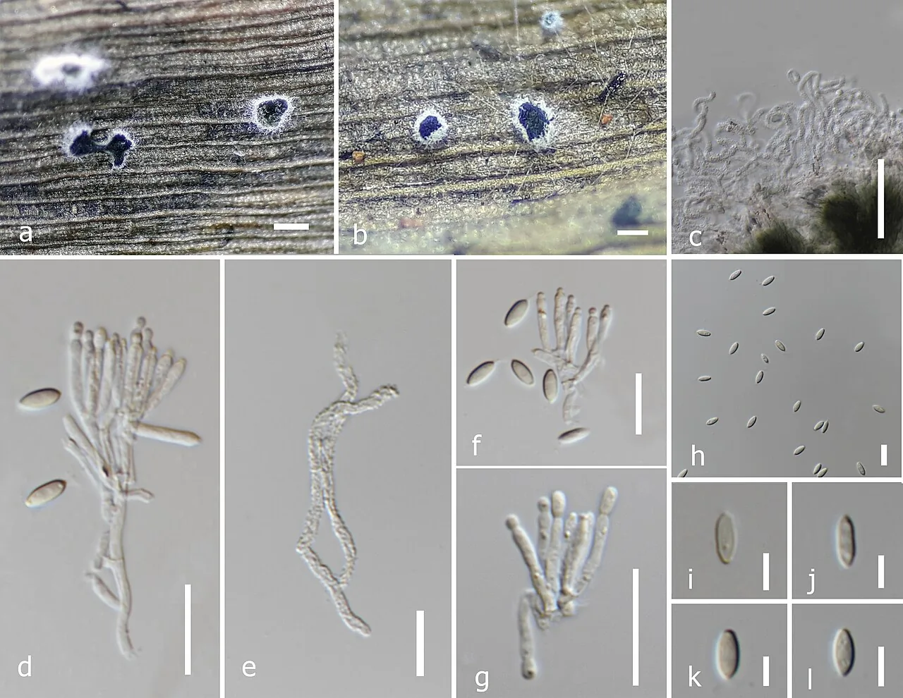 Albifimbria verrucaria (Albifimbria verrucaria) — photo mycologique