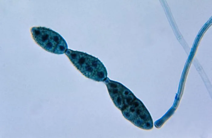 Alternaria macrospora (Alternaria macrospora) — photo mycologique