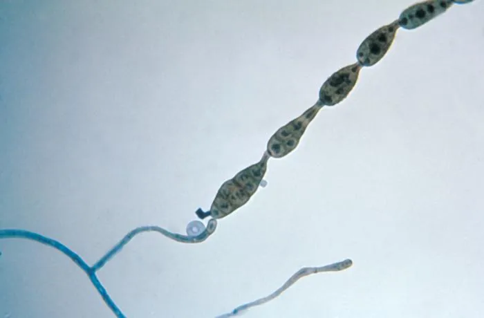 Alternaria multirostrata (Alternaria multirostrata) — photo mycologique