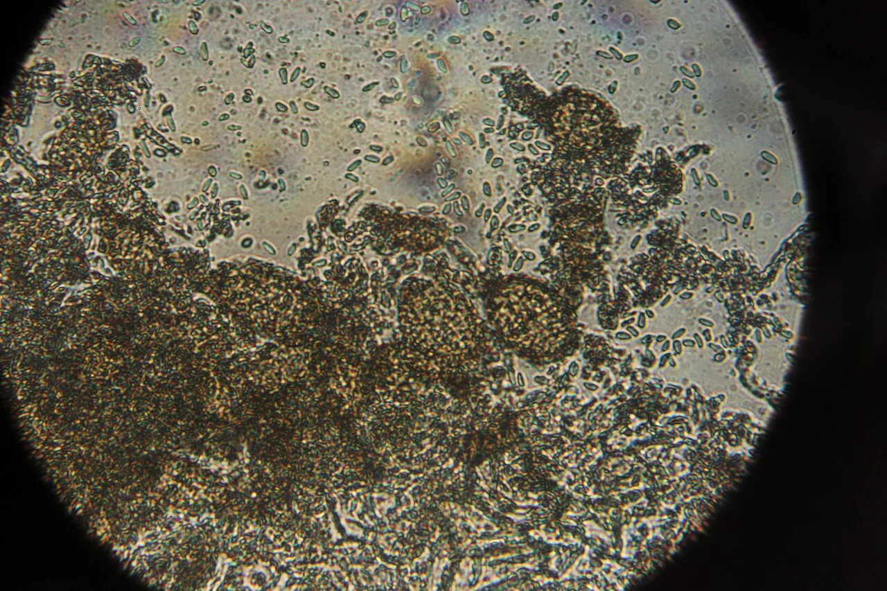 Ampelomyces humuli (Ampelomyces humuli) — photo mycologique