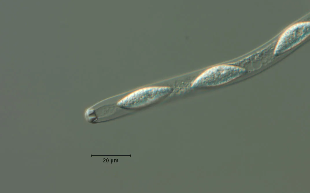 Annulatascus velatisporus (Annulatascus velatisporus) — photo mycologique