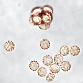 Aphanoascus pinarensis (Aphanoascus pinarensis) — photo mycologique