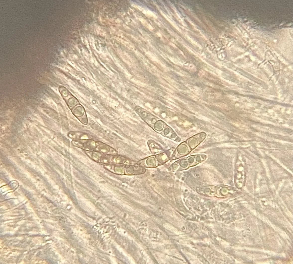 Aposphaeria salicum (Aposphaeria salicum) — photo mycologique
