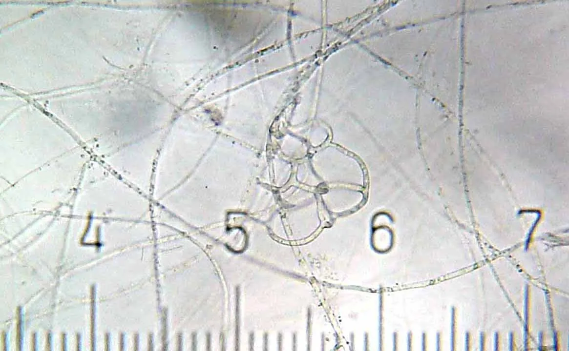Arthrobotrys pseudoclavatus (Arthrobotrys pseudoclavatus) — photo mycologique