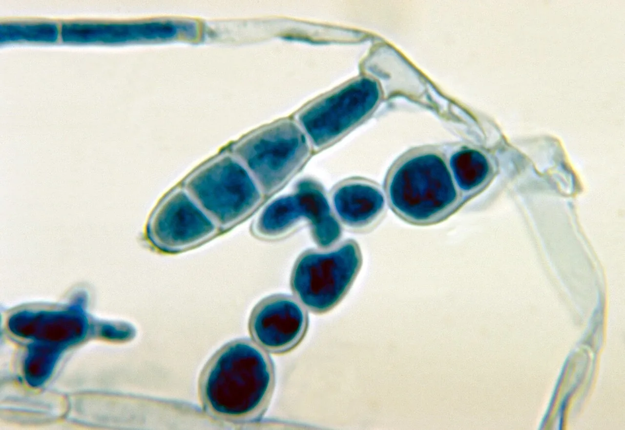 Arthroderma insingulare (Arthroderma insingulare) — photo mycologique