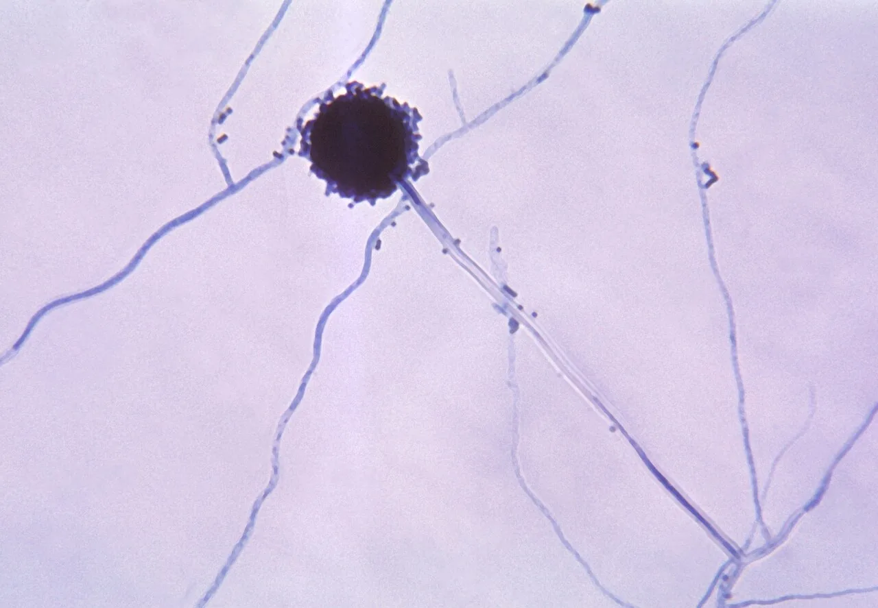 Aspergillus calidoustus (Aspergillus calidoustus) — photo mycologique