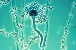 Aspergillus insolitus (Aspergillus insolitus) — photo mycologique