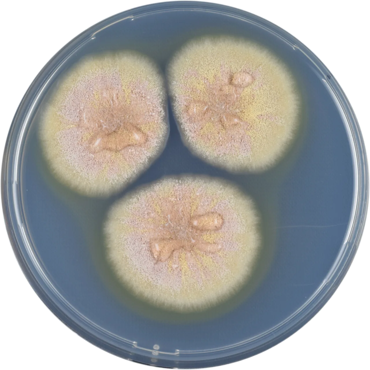 Aspergillus muricatus (Aspergillus muricatus) — photo mycologique