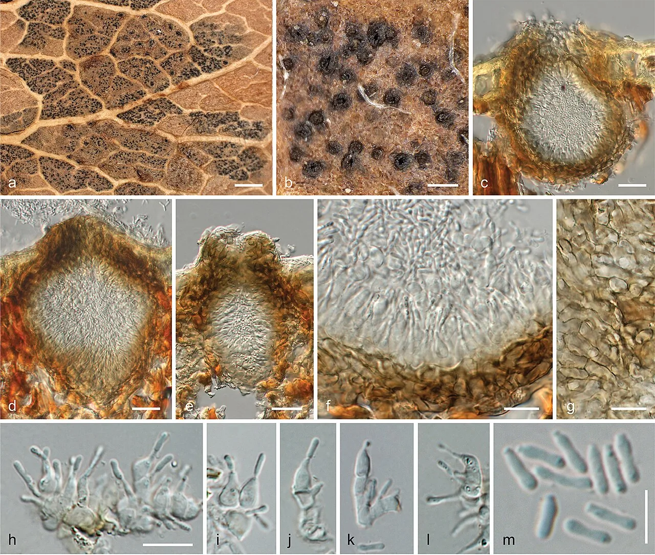 Asteromella thermopsidis (Asteromella thermopsidis) — photo mycologique