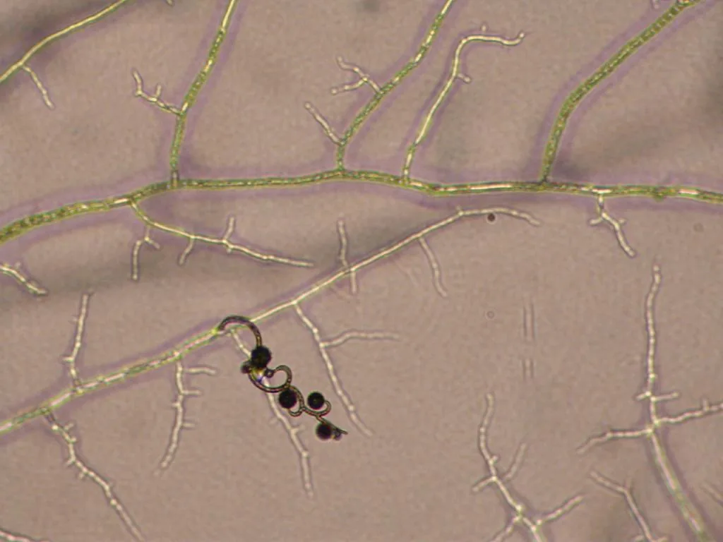 Backusella circina (Backusella circina) — photo mycologique