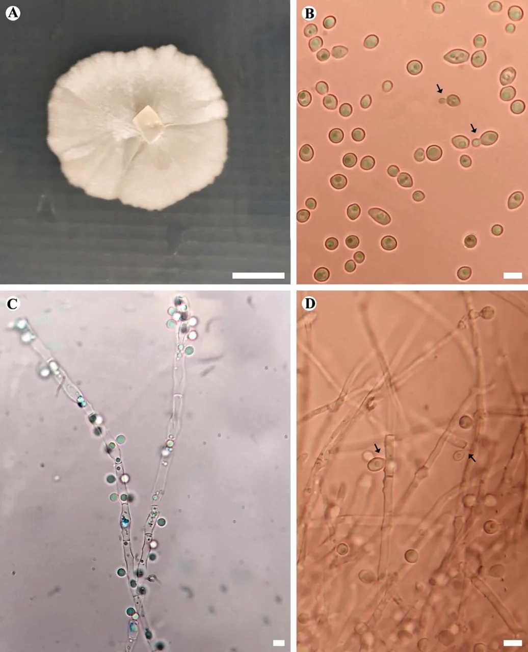 Blastobotrys malaysiensis (Blastobotrys malaysiensis) — photo mycologique