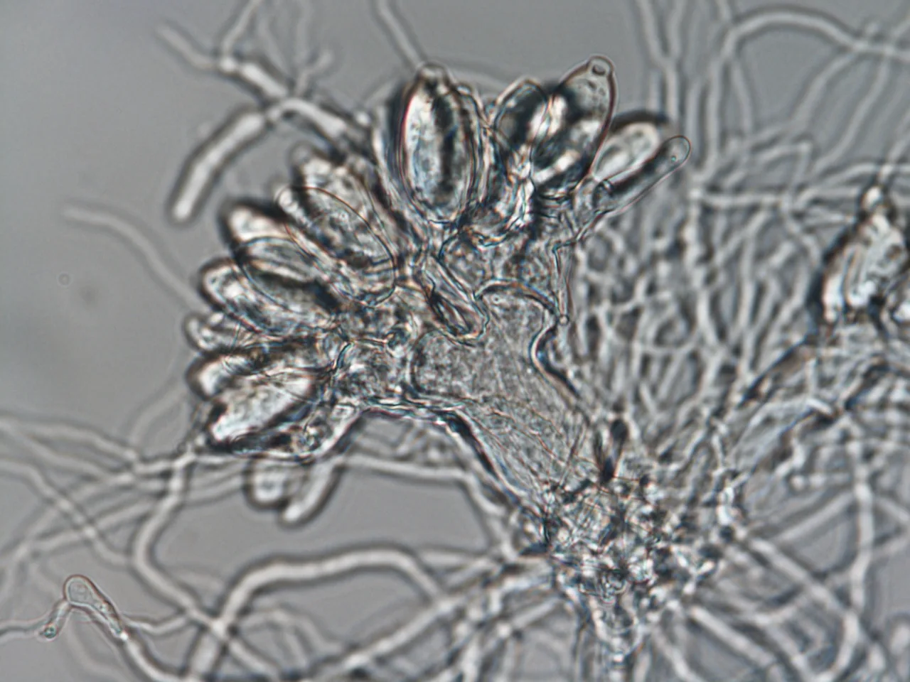 Blastocladia globosa (Blastocladia globosa) — photo mycologique