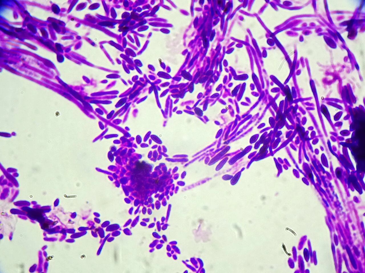Candida dubliniensis (Candida dubliniensis) — photo mycologique