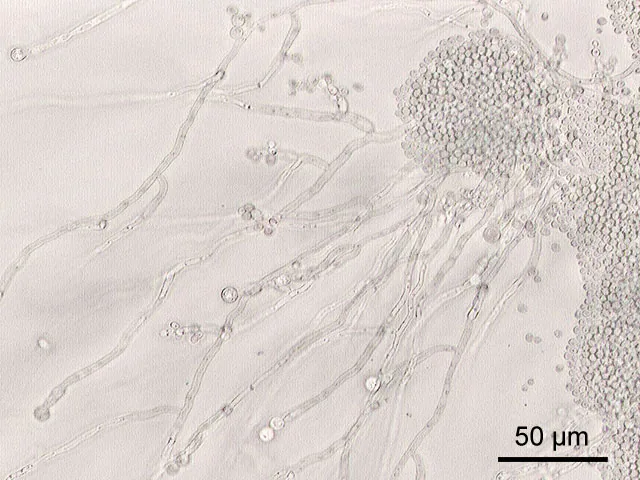 Candida ruelliae (Candida ruelliae) — photo mycologique