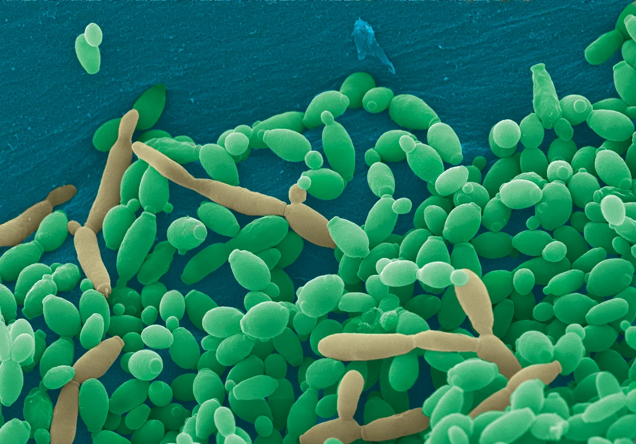 Candida tropicalis (Candida tropicalis) — photo mycologique