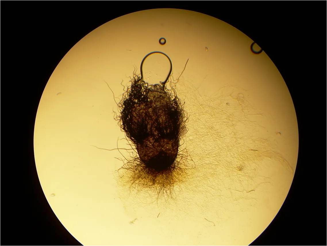 Chaetomium pilosum (Chaetomium pilosum) — photo mycologique