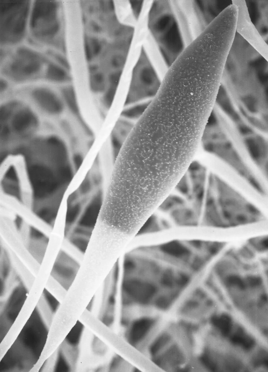 Chlamydoabsidia padenii (Chlamydoabsidia padenii) — photo mycologique