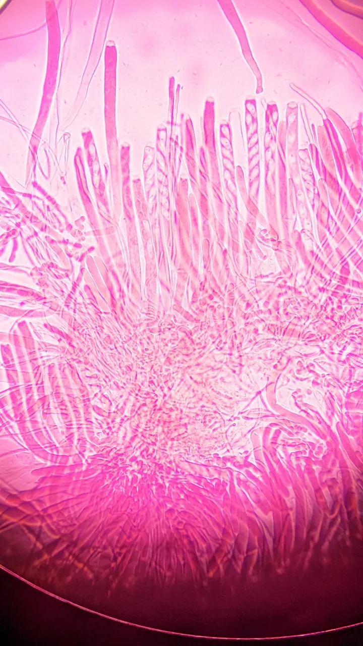 Ciborinia gracilis (Ciborinia gracilis) — photo mycologique