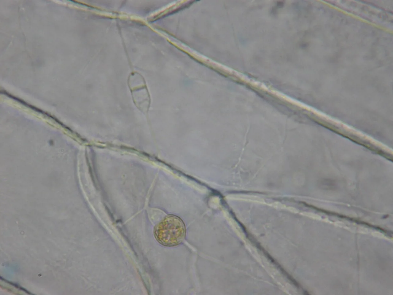 Cladochytrium sparganii-ramosi (Cladochytrium sparganii-ramosi) — photo mycologique