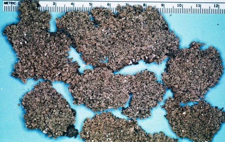 Cladonia apodocarpa (Cladonia apodocarpa) — photo mycologique
