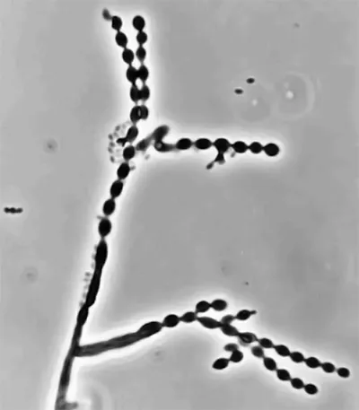 Cladophialophora minutissima (Cladophialophora minutissima) — photo mycologique