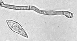 Clasterosporium flexum (Clasterosporium flexum) — photo mycologique