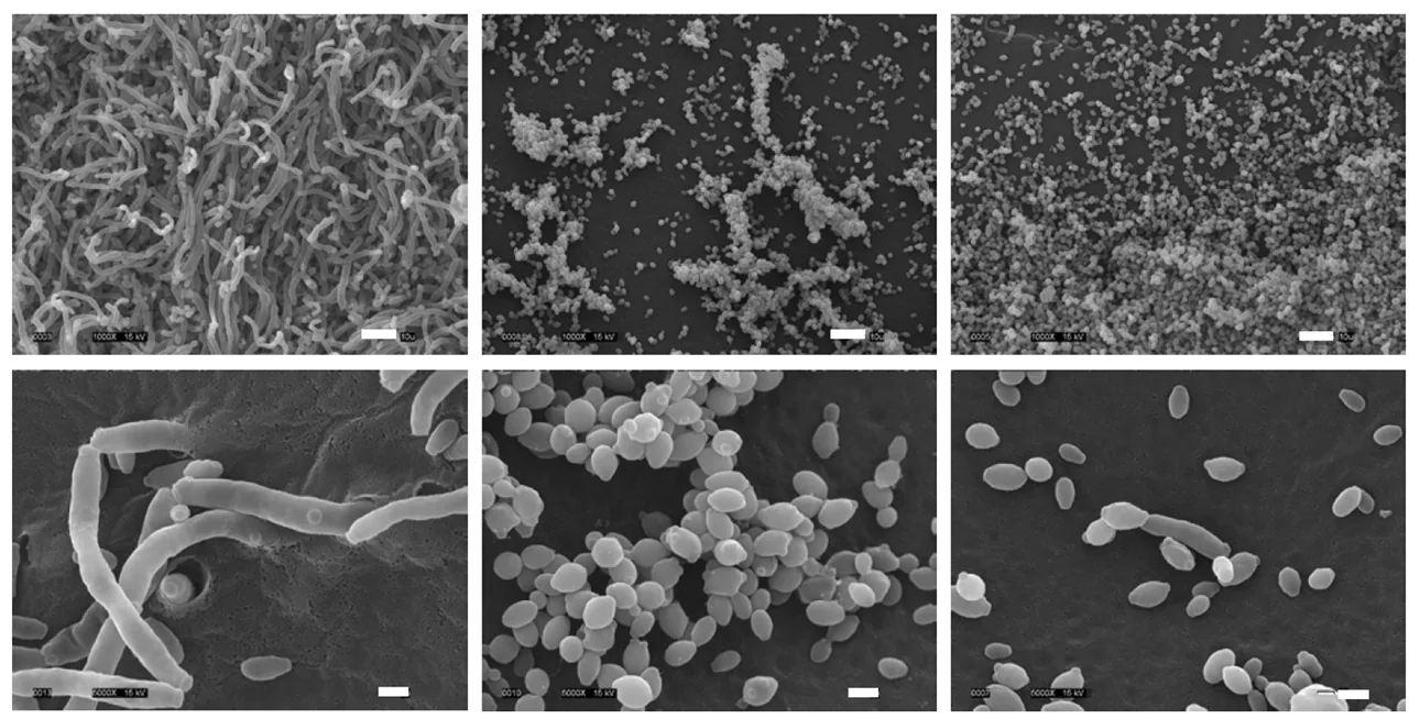 Clavispora lusitaniae (Clavispora lusitaniae) — photo mycologique