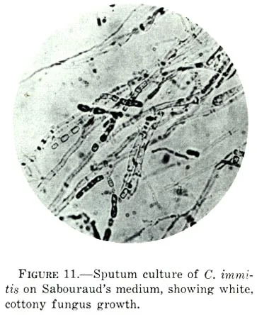 Coccidioides immitis (Coccidioides immitis) — photo mycologique