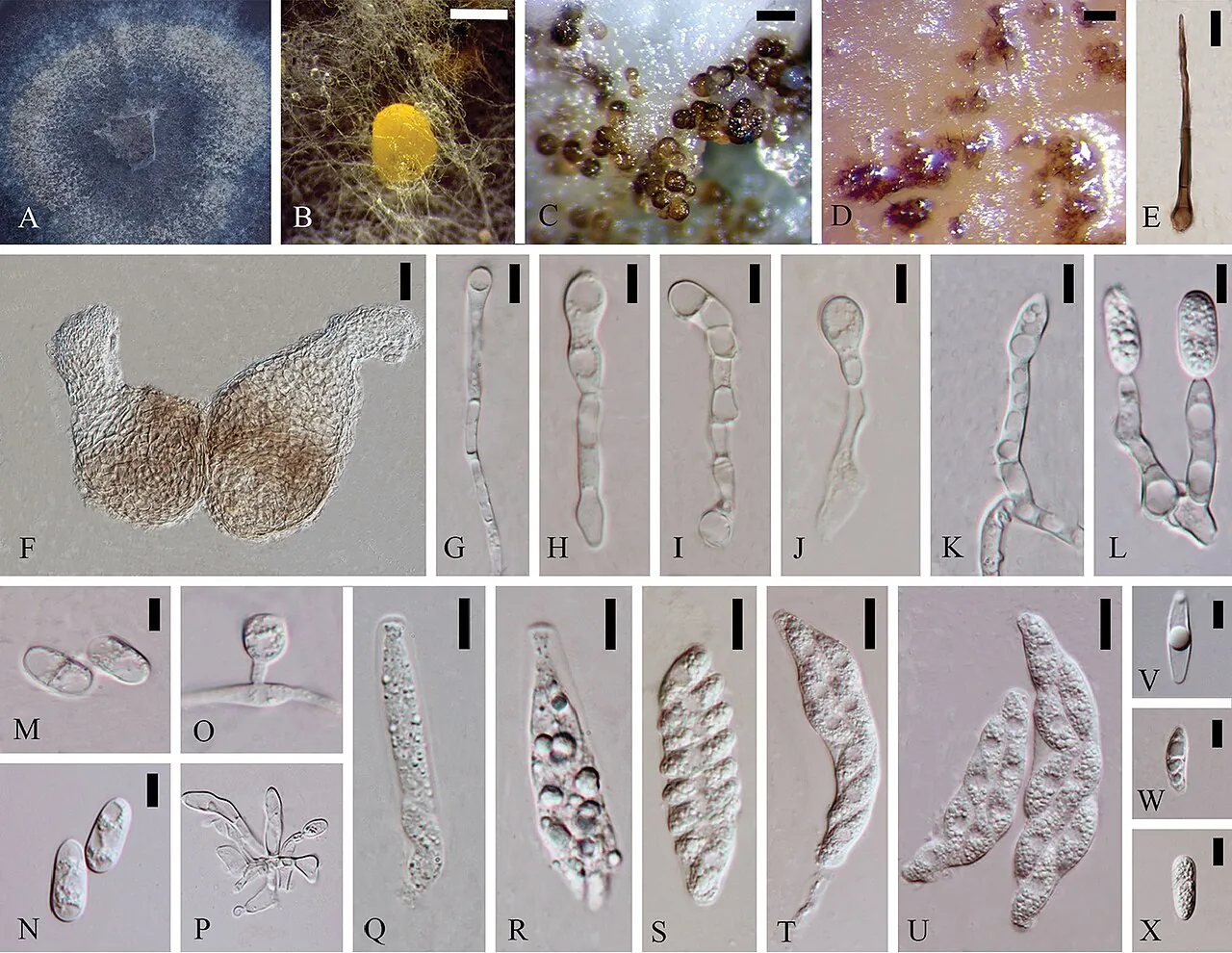 Colletotrichum citricola (Colletotrichum citricola) — photo mycologique