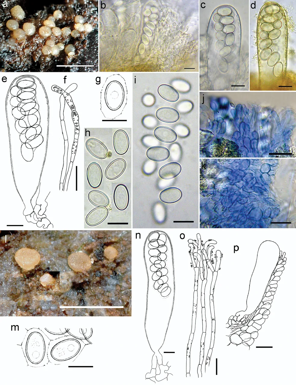 Coprotus granuliformis (Coprotus granuliformis) — photo mycologique