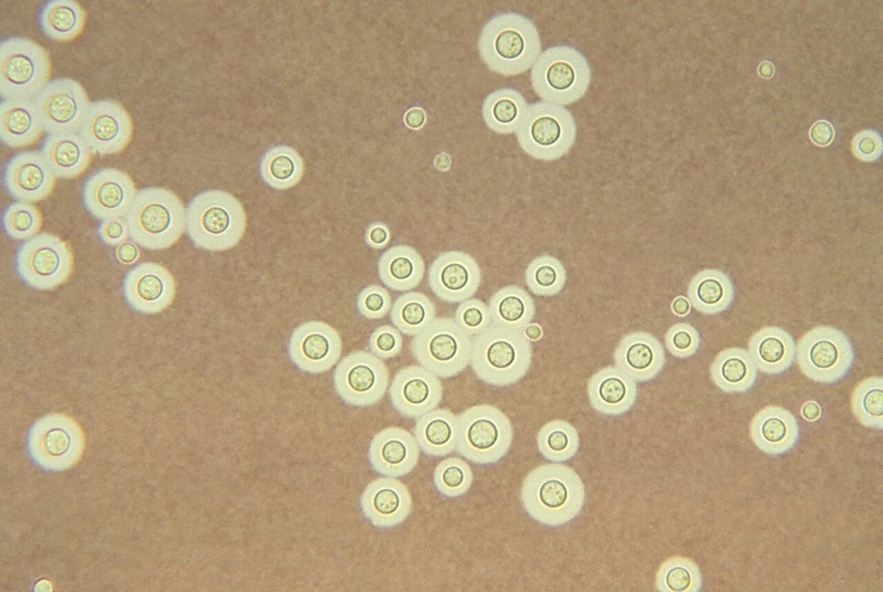 Cryptococcus heveanensis (Cryptococcus heveanensis) — photo mycologique