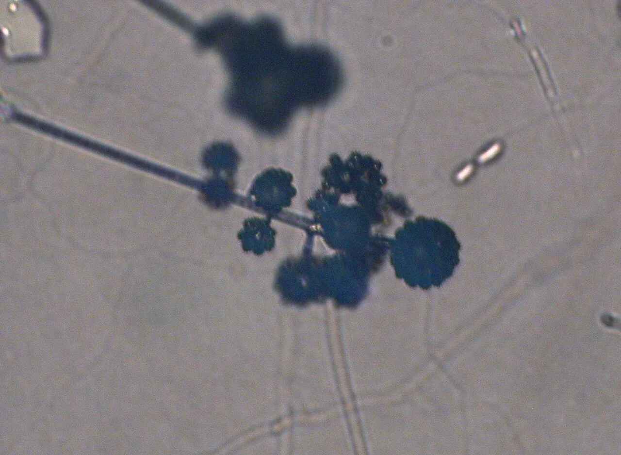 Cunninghamella polymorpha (Cunninghamella polymorpha) — photo mycologique