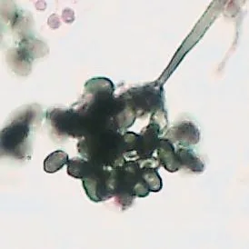 Digitiseta setiramosa (Digitiseta setiramosa) — photo mycologique