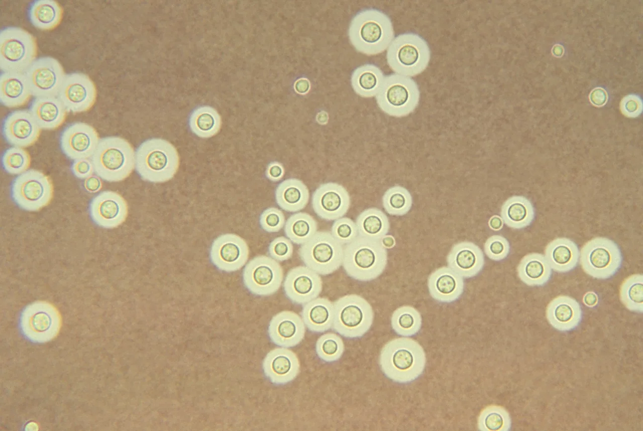 Dioszegia antarctica (Dioszegia antarctica) — photo mycologique