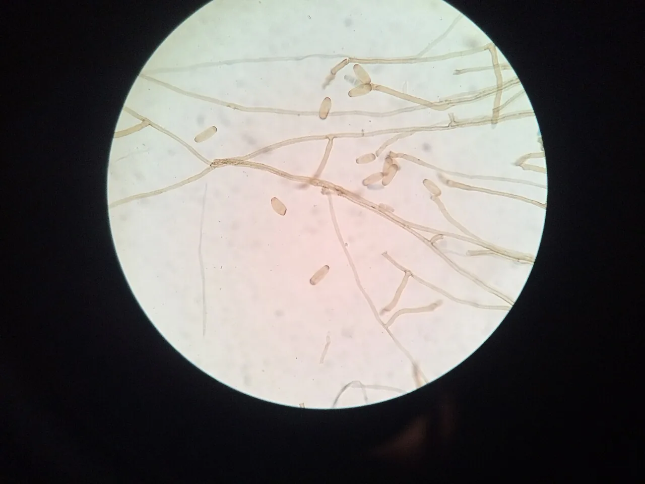 Drechslera andersenii (Drechslera andersenii) — photo mycologique