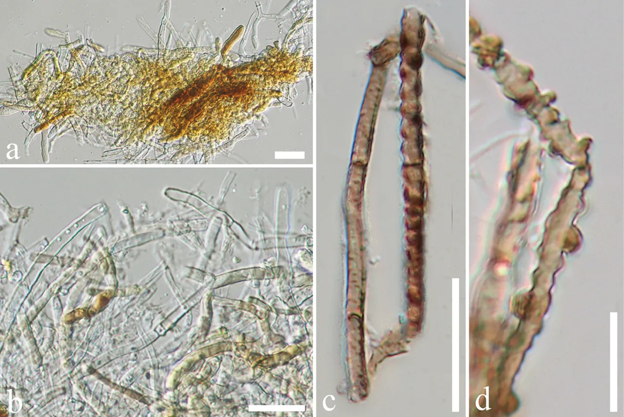 Endomelanconiopsis microspora (Endomelanconiopsis microspora) — photo mycologique