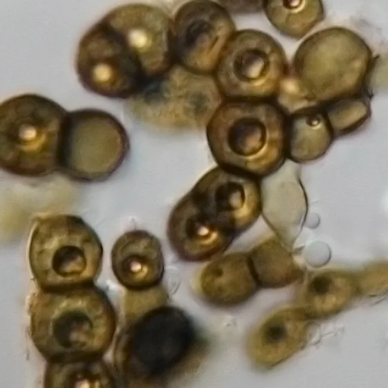 Exophiala attenuata (Exophiala attenuata) — photo mycologique