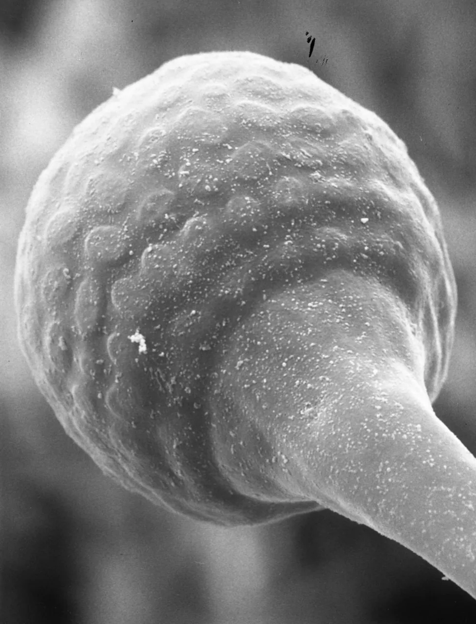 Fennellomyces gigacellularis (Fennellomyces gigacellularis) — photo mycologique