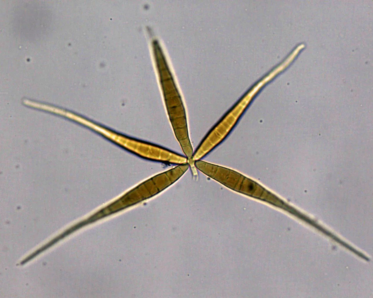 Flabellospora acuminata (Flabellospora acuminata) — photo mycologique