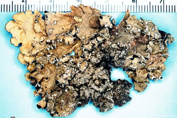 Flavopunctelia flaventior (Flavopunctelia flaventior) — photo mycologique