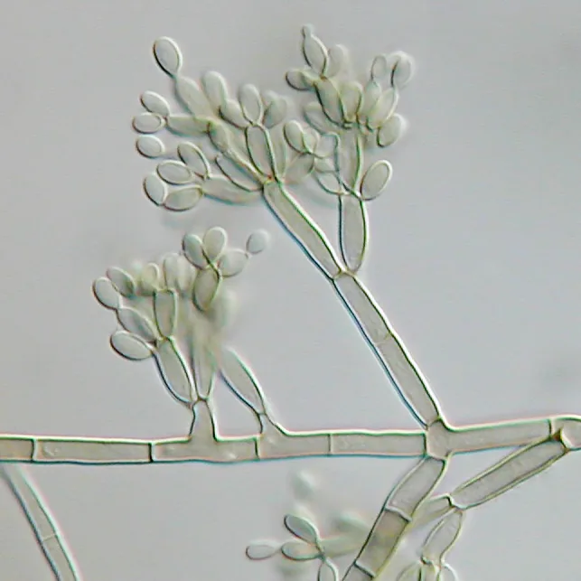 Fonsecaea nubica (Fonsecaea nubica) — photo mycologique