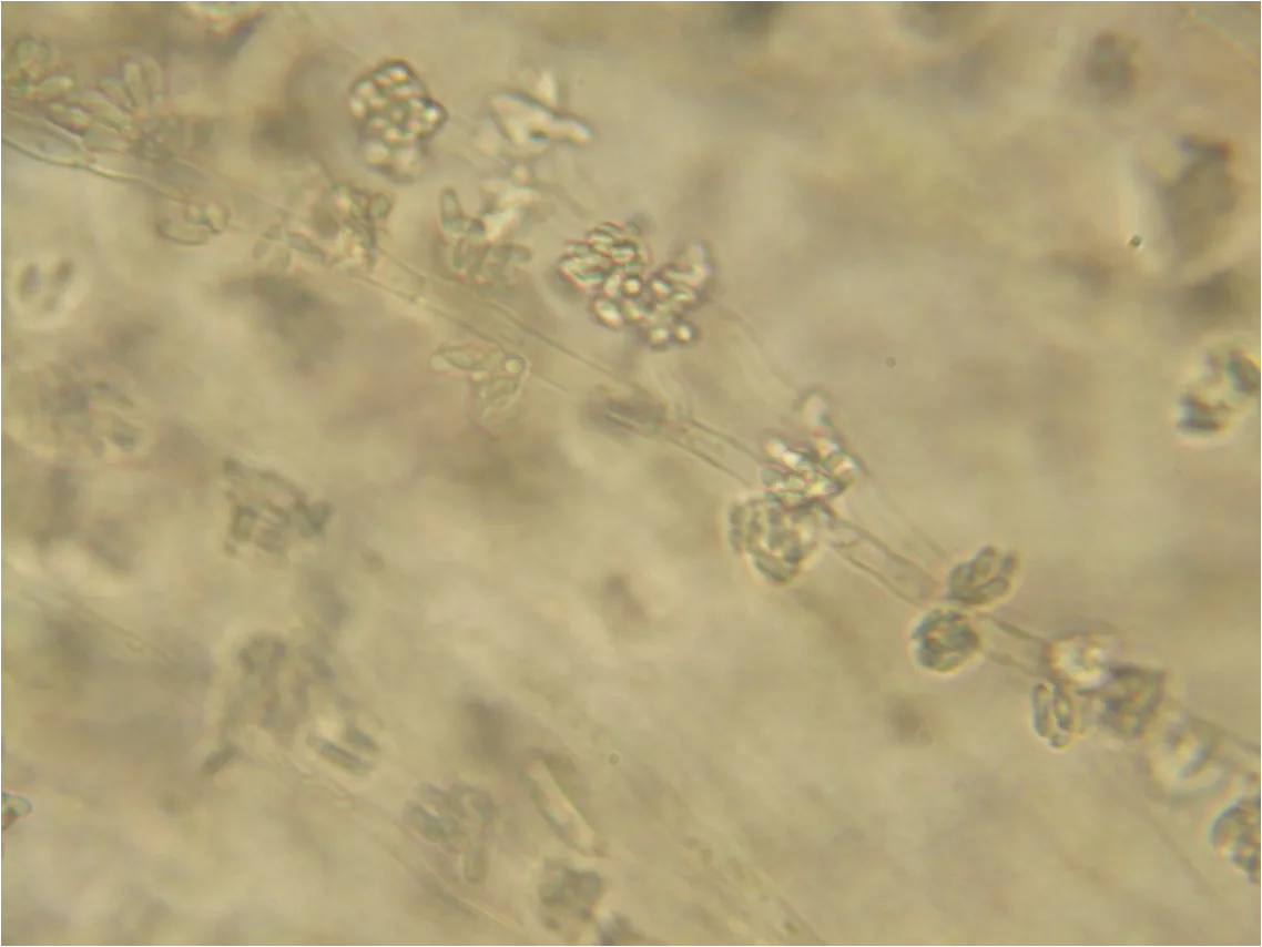 Gonatobotrys ramosa (Gonatobotrys ramosa) — photo mycologique