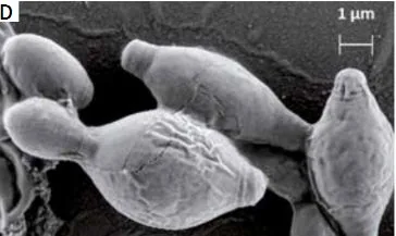 Hanseniaspora uvarum (Hanseniaspora uvarum) — photo mycologique