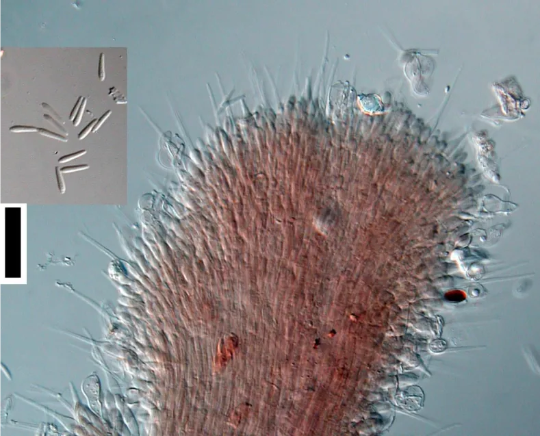Hirsutella minnesotensis (Hirsutella minnesotensis) — photo mycologique