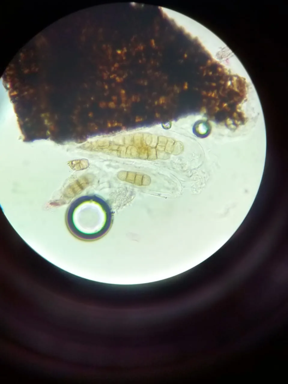 Leptosphaerulina hyperborea (Leptosphaerulina hyperborea) — photo mycologique