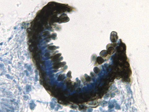 Lichenoconium usneae (Lichenoconium usneae) — photo mycologique