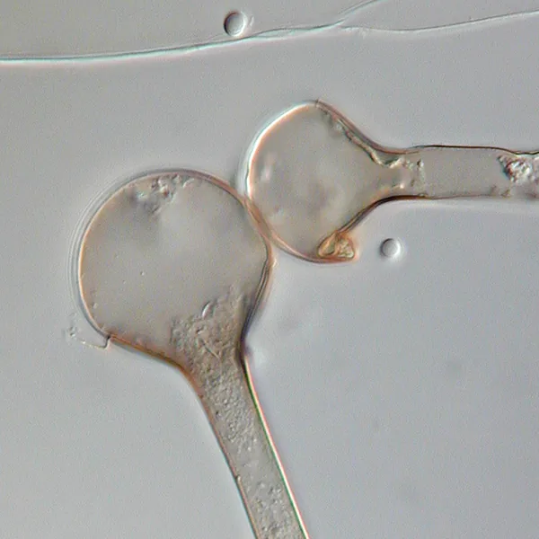 Lichtheimia sphaerocystis (Lichtheimia sphaerocystis) — photo mycologique