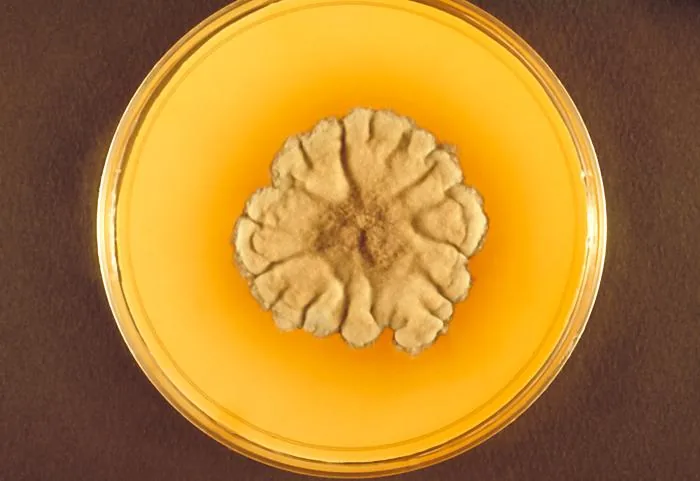 Madurella pseudomycetomatis (Madurella pseudomycetomatis) — photo mycologique